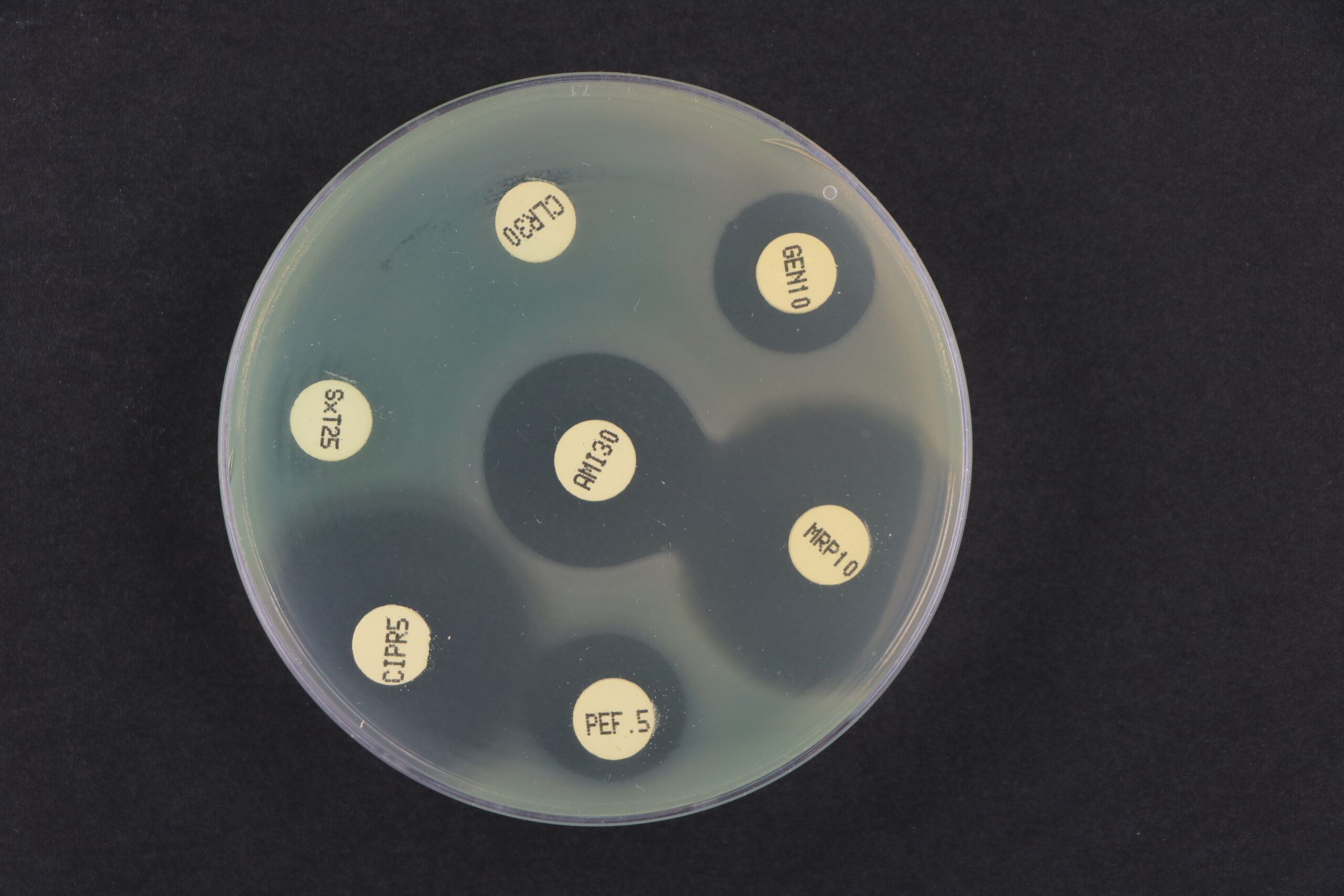 Nouvelles versions des tableaux des diamètres critiques des zones d’inhibition de CLSI et du EUCAST (2026)
